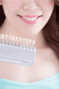 Clareamento em Santos - Solução Oral odontologia