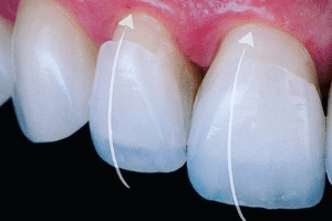 Lente de Contato - Solução Oral Odontologia